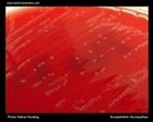 erysipelothrix rhusiopathiae on blood agar